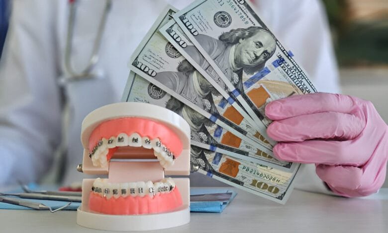 how much do braces cost