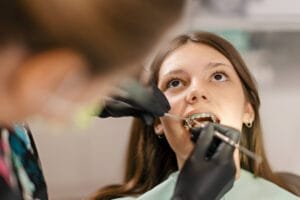 how much do braces cost