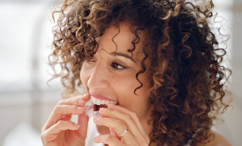 invisalign vs braces